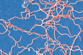 Image: Scanning electron micrograph of Borrelia burgdorferi (Photo courtesy of Janice Haney Carr).